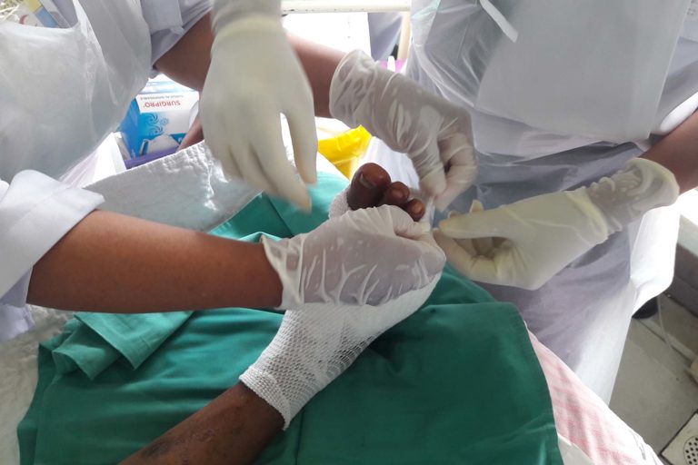 Cirurgia Ambulatorial: Desbridamento