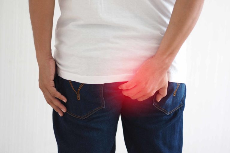 Cirurgia Hospitalar: Hemorroida